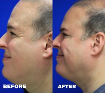 xr:d:DAFmcVNcIBo:2,j:6299804091328693248,t:23062109